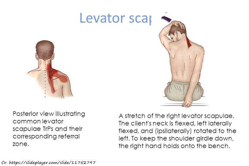 Levator Scap Stretch